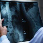 doctor looking at x-ray