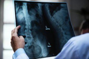 Learn how you can study chiropractic doctor looking at x-ray